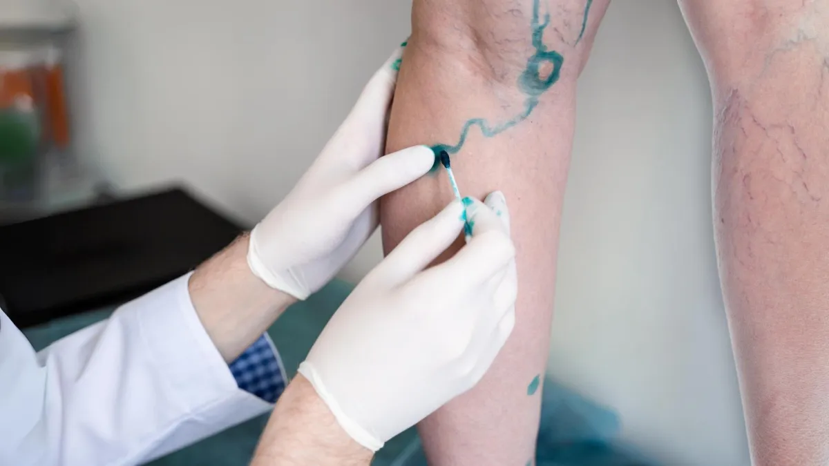 How Early Intervention With a Vein Specialist Can Prevent Serious Conditions