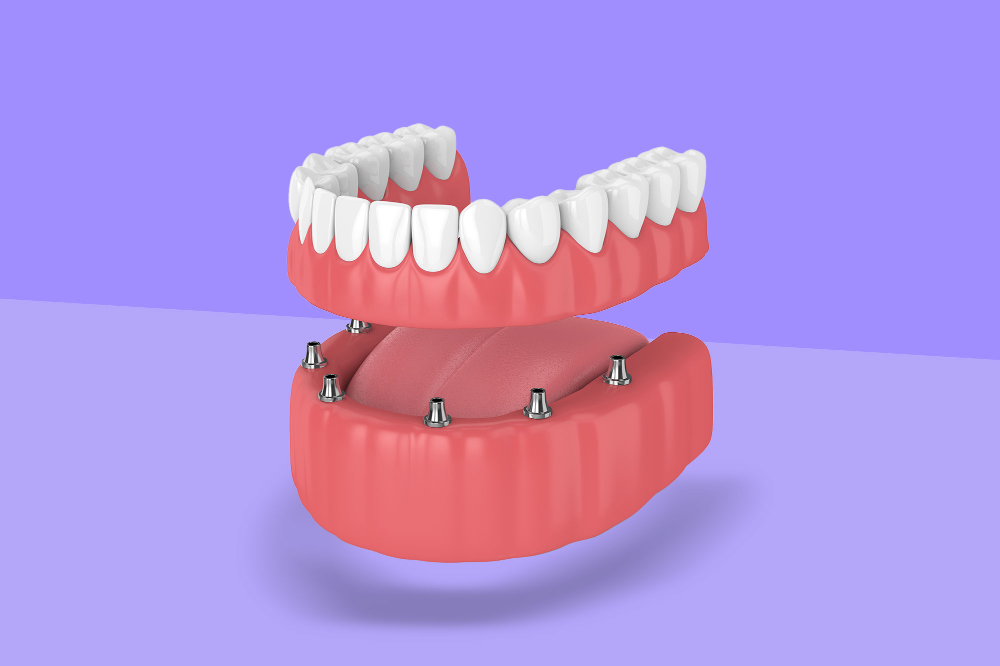 Innovative Denture Solutions