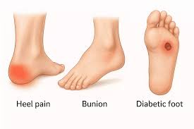 The Benefits of Visiting a Podiatrist for Foot Pain