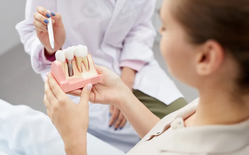 The Step-by-Step Process of Dental Implant Surgery