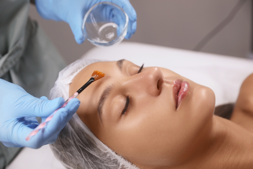 Understanding How Chemical Peels Work