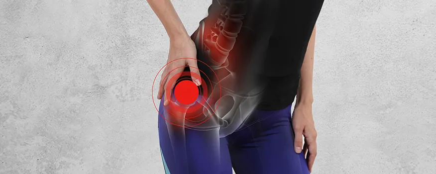 What You Need to Know About Managing Hip Pain