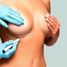 How to Prepare Physically for a Breast Lift