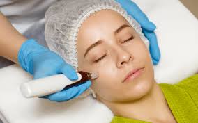 Integrating Microneedling Into Your Skincare Routine