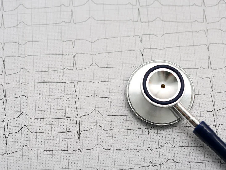 Tests and Procedures for Diagnosing Angina
