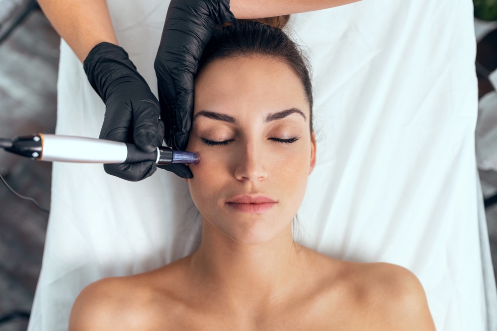 Understanding the Microneedling Process and Its Benefits